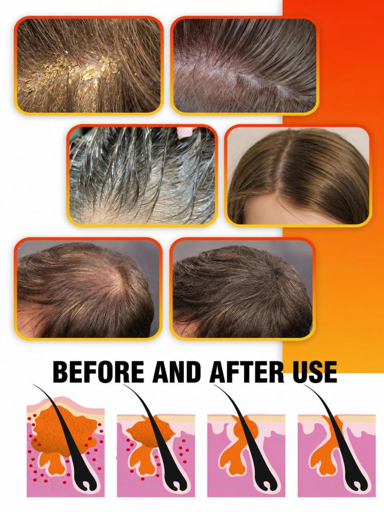 Herbal Anti-Dandruff Shampoo,  - Hair Care Dandruff recension och pris