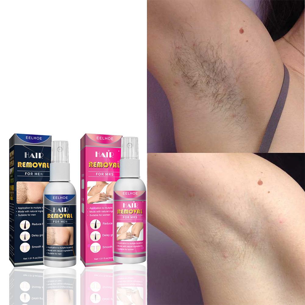 1/2PCS Super Natural Painless  - Hair Care Lotion recension och pris